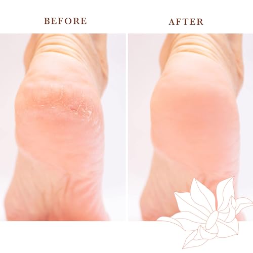 Natural Pumice Stone Foot Care Set - Exfoliates Dead Skin, Promotes Soft Feet - 1Pc
