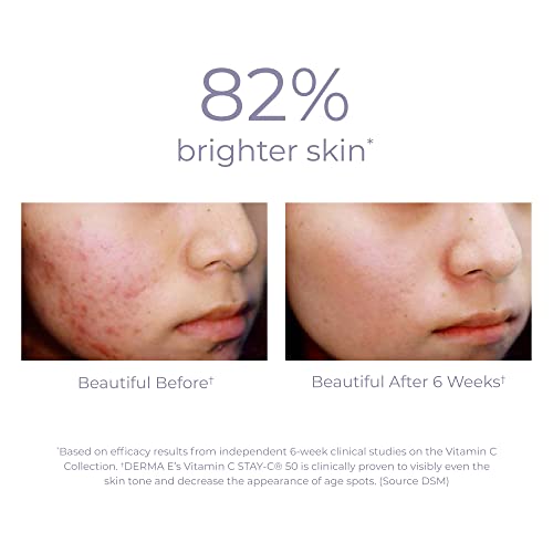 DERMA E Face Serum - Brightening & Firming with Vitamin C, Hyaluronic Acid, Aloe - 2oz