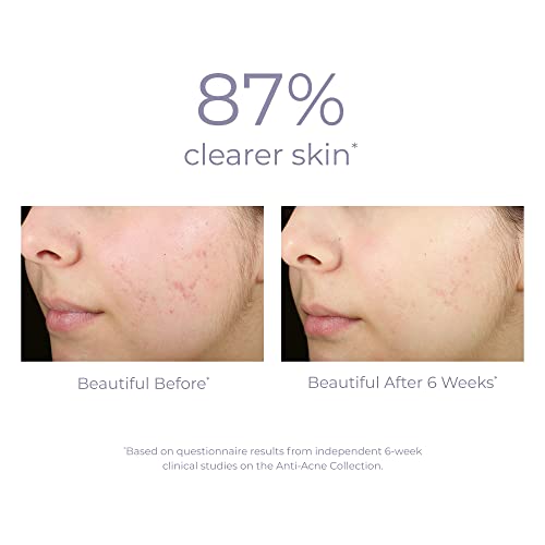 Derma E Blemish & Acne Treatment - Balances Skin, Reduces Redness & Irritation - 2 oz