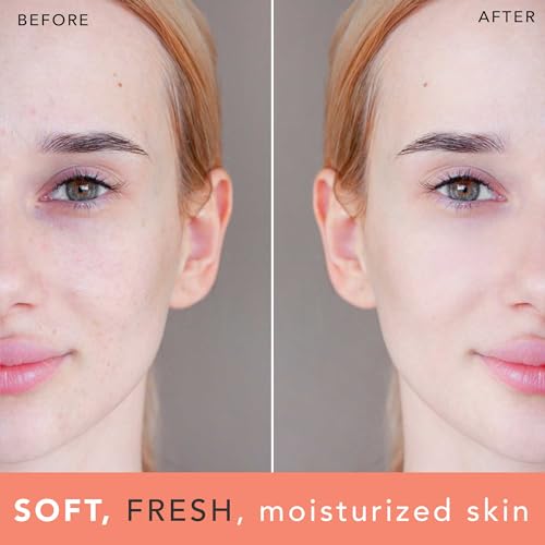 Rose Water Face Toner - Hydrating, Alcohol-Free, Reduces Redness, Refines Pores - 8oz