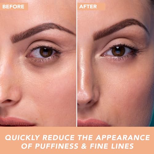 USA Made Eye Cream - Reduces Dark Circles & Puffiness, Hydrates with Hyaluronic Acid - 0.5oz