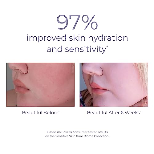 Derma E Moisturizer - Balances Skin Microbiome, Nourishes Sensitive Skin - 2 OZ