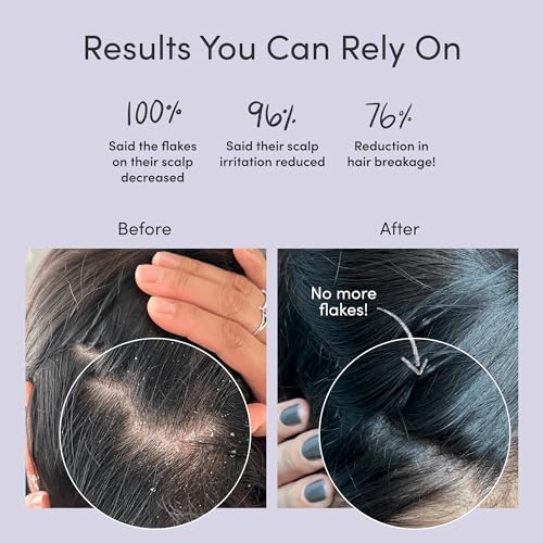 Jupiter Shampoo & Conditioner - Relieves Itchy Scalp, Nourishing Formula - 9.5 fl oz Each